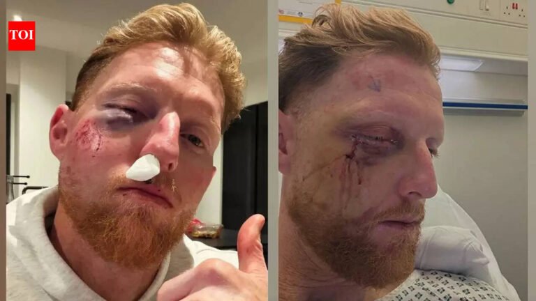 Ben Stokes undergoes facial surgery after freak net hit, England captain shares photos Cricket News