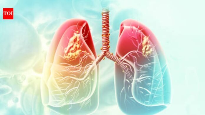 AIIMS-Delhi to study link between lung cancer and air pollution

