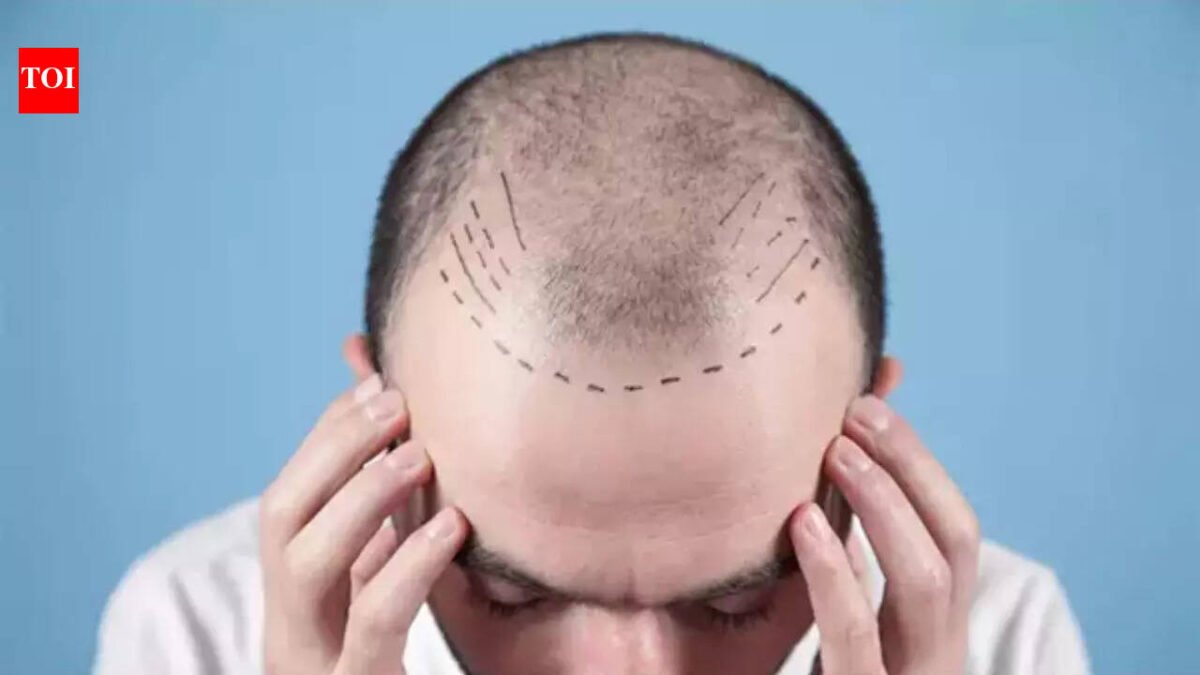 The TN order comes days after doctors seek similar regulations across the country as a hair transplant craze triggers safety alarms