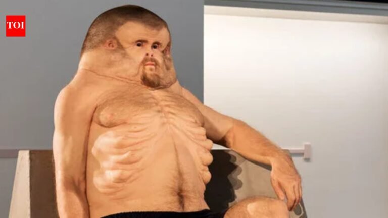 This is what the human body looks like after surviving a car accident, according to science |