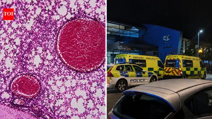 Meningitis outbreak triggers alarm after one student dies, two others fall ill in reading area


