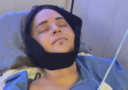 Rosanna Pansino Surgery: YouTuber Rosanna Pansino undergoes surgery after breaking jaw in boating accident