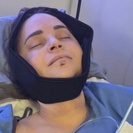 Rosanna Pansino Surgery: YouTuber Rosanna Pansino undergoes surgery after breaking jaw in boating accident
