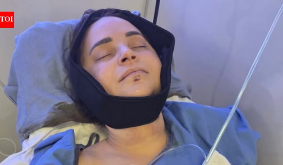 Rosanna Pansino Surgery: YouTuber Rosanna Pansino undergoes surgery after breaking jaw in boating accident