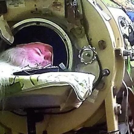 Martha Lillard: Last U.S. polio patient to use iron lung, Martha Lillard dies