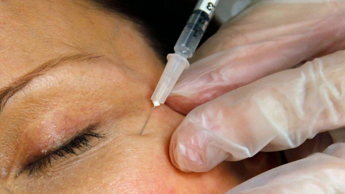 Zombie fillers: Dead man's fat is the latest beauty trend