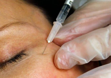 Zombie fillers: Dead man's fat is the latest beauty trend