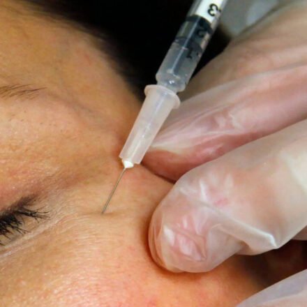 Zombie fillers: Dead man's fat is the latest beauty trend
