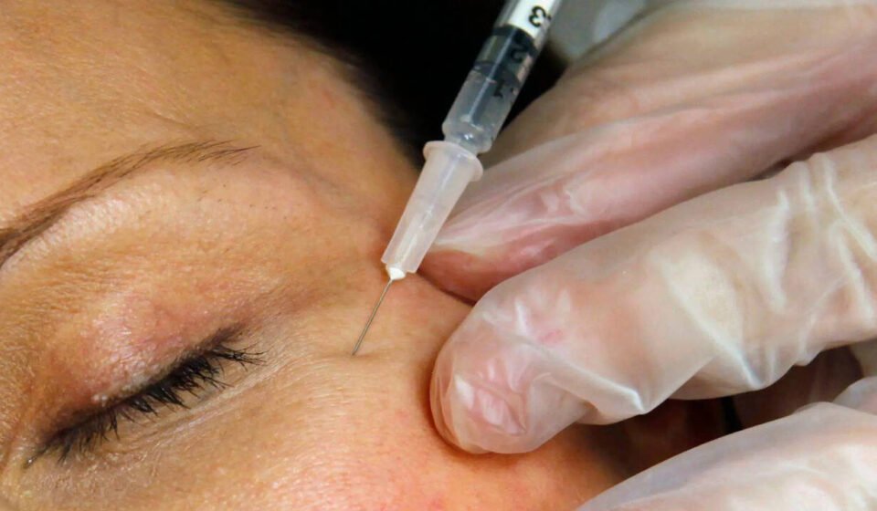 Zombie fillers: Dead man's fat is the latest beauty trend