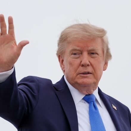 Trump was diagnosed with chronic venous insufficiency in 2025. (AP)