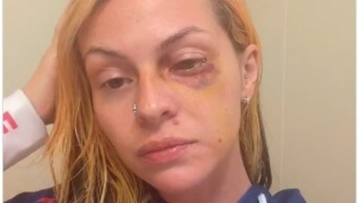 Pamalla Rodriguez launched a GoFundMe campaign for medical and legal expenses after allegedly being assaulted by rapper Famous Dex. (Instagram)