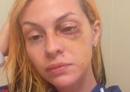 Pamalla Rodriguez launched a GoFundMe campaign for medical and legal expenses after allegedly being assaulted by rapper Famous Dex. (Instagram)