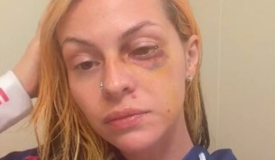 Pamalla Rodriguez launched a GoFundMe campaign for medical and legal expenses after allegedly being assaulted by rapper Famous Dex. (Instagram)