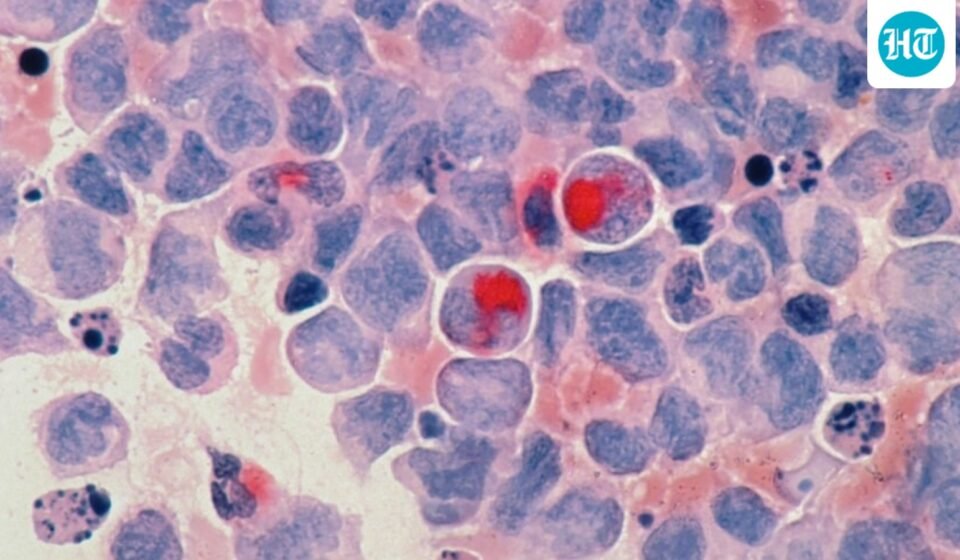 FDA officials gave expedited approval to daraxonrasib, which blocks a mutated protein that fuels tumor growth. (Representational) (Unsplash)