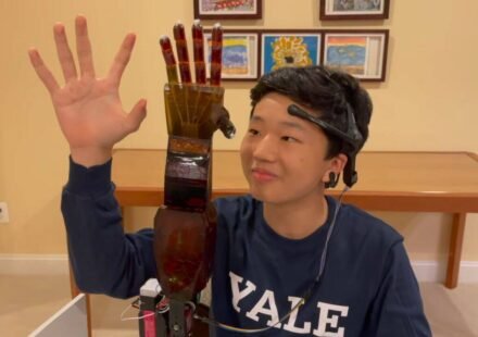 Meet Benjamin Choi, a 17-year-old who built a $300 mind-controlled prosthetic arm that reads brainwaves through non-invasive electrodes