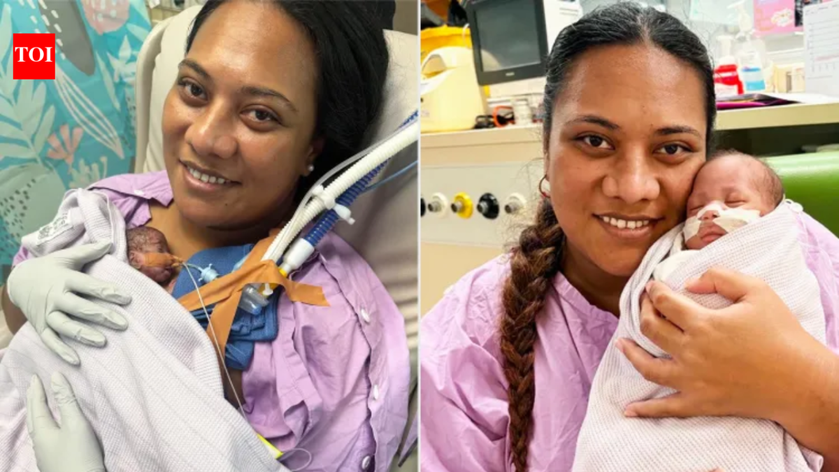 An Australian woman learned she was pregnant and could give birth ‘any day’ within 24 hours; her daughter arrived at 21 weeks 3 days and became the country’s most premature baby to survive
