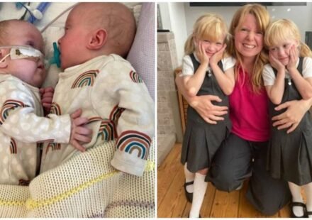 Mother of twin girls given less than 10% chance of survival after TTTS at 16 weeks; after surgery, premature birth and 300 days in hospital, twins now prepare for first day of school
