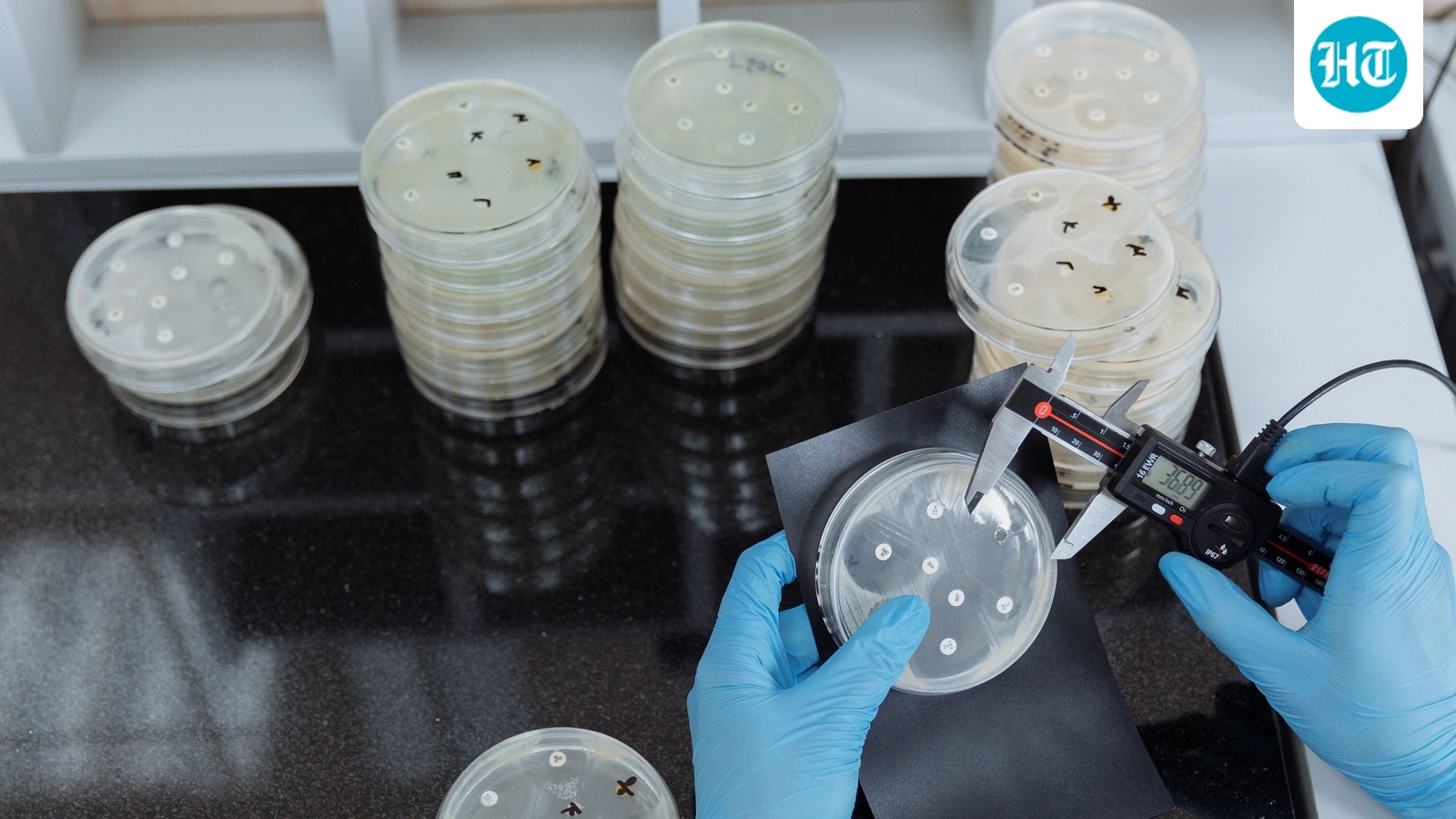 Bacteria that causes deadly Legionnaires’ disease discovered at LA Medical Examiner’s Office, employee tests positive (Pexel - representational image)